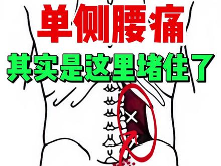 单侧腰痛 多半都跟这块肌肉有关系! #腰痛改善 #腰痛怎么办 #腰方肌 #腰肌劳损 #单侧腰痛