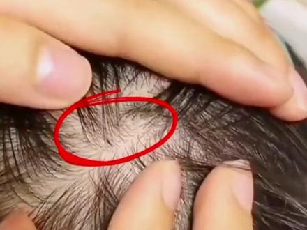 夏天出汗孩子头上也容易长虱子的,一定要备上这个#去虱洗发水 ,温和不刺激又好用,儿童头虱一扫净,去虱卵非常不错,洗完头发不干涩,也没有虱子了。#种草 #洗发水推荐#宝妈带娃 #洗发水