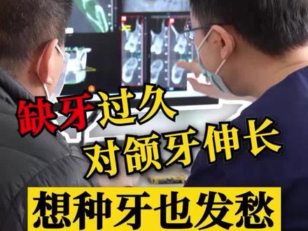 案例分享:缺牙太久会有什么危害?对牙伸长之后还能种牙吗?#北京种植牙 #口腔科刘博闻