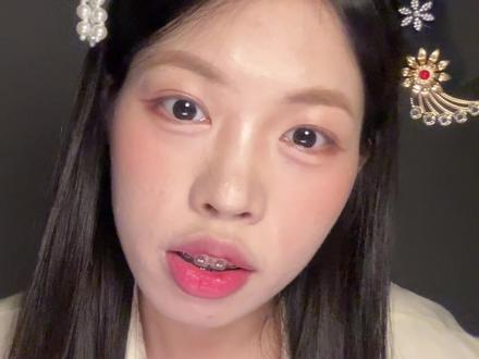 26岁才开始戴牙套,还来得及吗???来自大龄正畸人的真实经验分享。#牙套 #牙套日记 #正畸 #钢牙妹 #大龄正畸