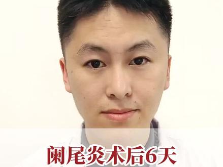 阑尾炎术后6天饮食用餐指南助您快速恢复 #硬核健康科普行动