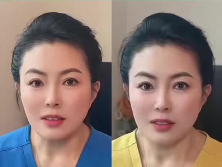 前壁胎盘怕磕,后壁胎盘怕累,哪个位置好?#孕妈#怀孕前壁胎盘和后壁的区别#怀孕#孕期