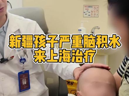 新疆严重脑积水孩子来上海求医#医者仁心#脑积水#新疆