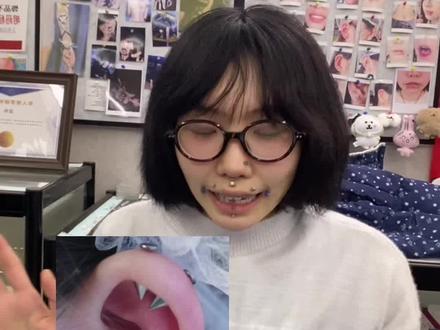 聊聊今年很火的双耳窝钉!! 很少有我养不下去的钉子哈哈哈耳窝是其中一个
#真实生活分享计划 #穿孔#杭州穿孔#穿孔师#耳窝钉