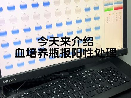 宁卫血培养阳性瓶操作