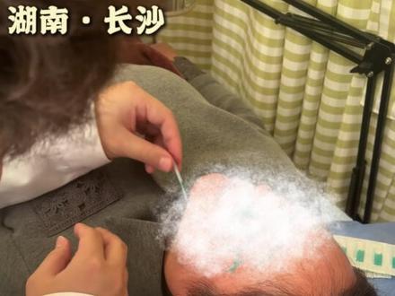 变美高能量日常,一针一针扎出来的真实变化! #变美 #美容 #美白淡斑 #长沙 #皮肤暗沉