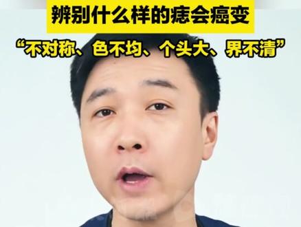 这几个地方长“痣”要当心!医生教你辨别什么样的痣会癌变:“不对称、色不均、个头大、界不清”