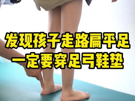发现孩子走路扁平足,一定要穿足弓鞋垫#扁平足 #医学科普 #扁平足 #矫形