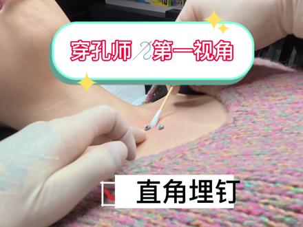 把钻石埋在胸口💎
#西安穿孔 #西安穿孔扛把子 #直角埋钉 #埋钉