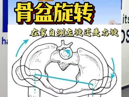 骨盆旋转教您一招在家自测#骨盆旋转 #骨盆