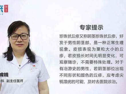 珍珠状丘疹怎么办?医生是这么说的!