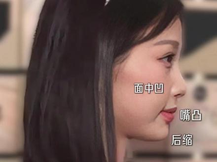 为啥侧脸不好看,演不了大美女 #双轨 #虞舒欣 #侧脸