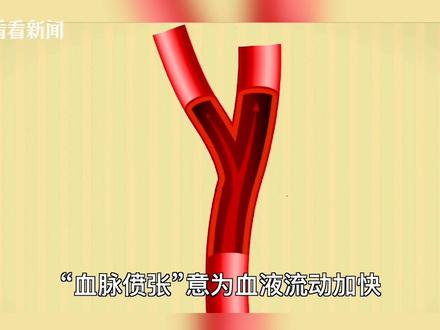 2021年十大语文差错•“血脉偾张”误为“血脉喷张”
“偾”读fèn,指亢奋,“偾张”指扩张突起,“血脉偾张”意为血液流动加快,血管膨胀,青筋鼓起,多用来形容激动、亢奋、激情。“喷张”指张裂喷射,“血脉喷张”即鲜血喷射,用来形容情绪激动显然不合情理。