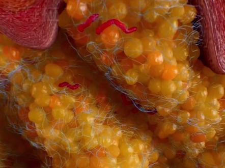 为什么人的脂肪是黄色的?而猪的是白色的#科普一下 #脂肪脂肪快走开 #科普健康知识 #没用的知识又增加了