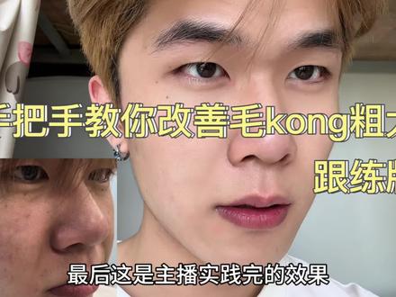 温和缩芼孔方法,建议看到最后!#护肤#毛孔粗大#毛孔#养颜#男生护肤