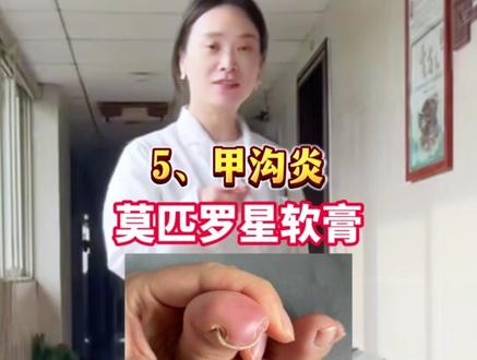 8种常见的皮肤病,医生教你如何正确处理! #皮肤 #皮肤病 #涨知识 #医学科普 #武汉皮肤科刘晶