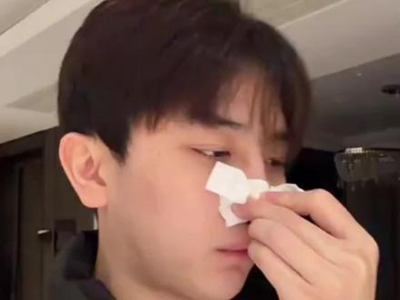 升级鼻扩张明星鼻撑鼻带扩张鼻孔睡眠运动打呼鼻塞改善通气鼻贴#鼻贴 #鼻撑 #打呼噜怎么治 #止鼾