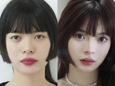 走心分享 正畸到底普通女孩带来了什么?#女生必看 #变美思路 #正畸