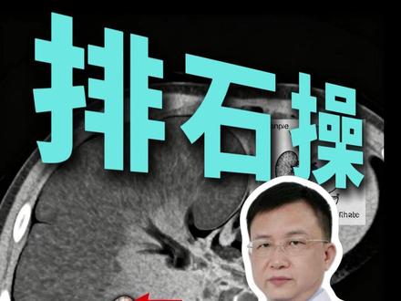 6cm以下的肾结石,教你四个动作排石 #排石操 #肾结石 #抖出健康知识宝藏 #科普