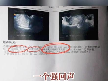 月经后总是滴滴答答不干净?妇产科专家建议这么应对#月经拖尾 #医学科普 #关爱女性健康 @抖音小助手