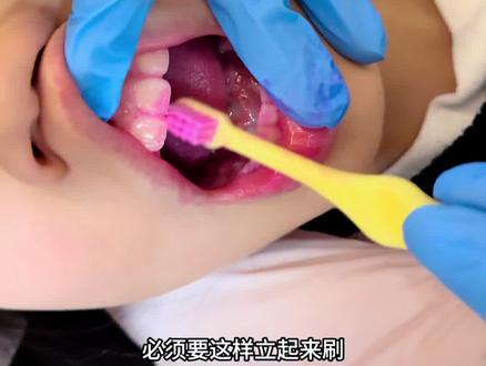 2分钟手把手教会你给孩子正确刷牙 周末啦!每天都要认真刷牙哦
1️⃣干刷,记得口内和牙刷都不要沾水哦
2️⃣口内分区,左上右上左下右下
3️⃣牙齿分面,外面里面咬合面
注意每天刷牙两次,每次至少两分钟哈,晚上刷牙更重要哦~
#正确刷牙 #刷牙的正确方法 #刷牙的小朋友 #儿童牙膏 #知识科普