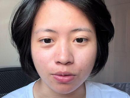 最近你是不是掉发严重?