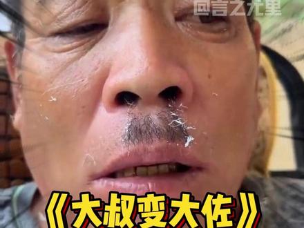 大叔:我就拔个胡子咋还给我国籍改了~#蜜蜡脱毛 #万万没想到