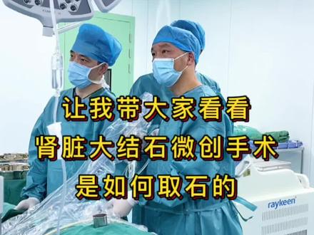 #分享健康知识 #关注健康关注我 肾脏大结石微创手术创伤小、恢复快,您值得信赖!#微创手术 #手术日常