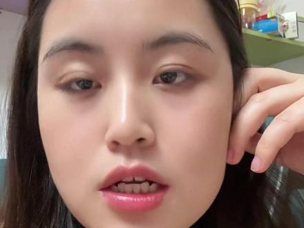 养老护理院四级就是中级考试内容,一共36项,前面我说了18项,接着跟你们说后面的18项,养老护理员四级含金量是非常高的,你们对这个感兴趣的,一定要给我点赞收藏
19. 观察老人用胰岛素后血糖异常变化
20. 识别老人跌倒等常见风险,及时报告并提供预防措施
21. 判断老人跌倒后急性创伤等情况并立即报告
22. 观察识别导管及造瘘口异常,取标本送检、记录上报
23. 协助Ⅱ度压力性损伤老人照护
24. 为临终老人提供沟通和陪伴
25. 为老人遗体清洁、整理遗物,进行终末消毒
26. 陪同有异常情况老人就医
27. 带老人做手口趣味活动操,与焦虑老人沟通
28. 带认知功能障碍老人做益智拍手操,与照护团队沟通
29. 带认知功能障碍老人用沙铃音乐律动,与抑郁老人沟通
30. 指导老人用套珠训练记忆力,与恐惧老人沟通
31. 指导老人用简易健身器材,与家属沟通
32. 指导老人穿脱衣康复训练,与焦虑老人沟通
33. 协助压力性尿失禁老人功能训练,与照护团队沟通
34. 指导老人用简易康复器材做手功能训练,与抑郁老人沟通
35. 指导老人坐位平衡训练,与恐惧老人沟通
36. 指导老人选择并使用手杖行走训练,与家属沟通