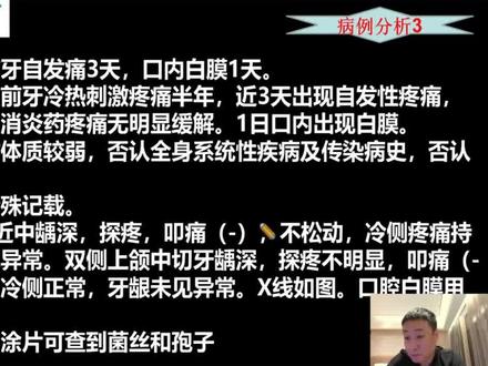 如果病例分析抽到这题,你会诊断吗? #口腔技能考试 #口腔执业医师考试 #口腔医考 #病例分析 #口腔技能实践操作考试