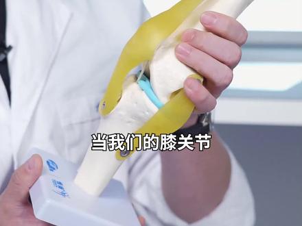 什么是膝关节绞索,1分钟给你解释明白 #膝关节绞索 #骨科 #医学科普 #健康科普