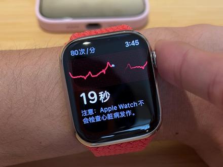 国行版 Apple Watch 心电图功能体验#数码 #数码科技 #电子产品