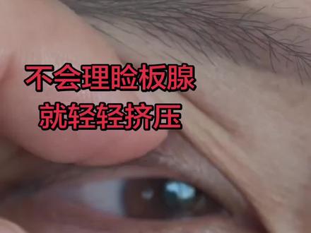 不会理睑板腺,就轻轻挤压#干眼症#睑板腺按摩@抖音创作小助手 @抖音小助手