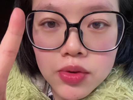 令人闻风丧胆的眼底筛查#小詹碎碎念