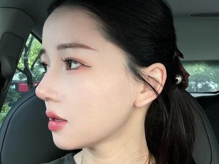 肋骨👃术后48天 #隆鼻经历 #做完鼻子后的改变 #隆鼻记录