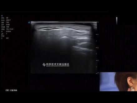 超声小白教程-涎腺扫查(腮腺、颌下腺、舌下腺)#超声 #学习打卡 @DOU+小课堂