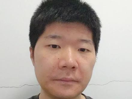 正颌手术是怎么做的,简单讲一下。说的不好请谅解。
#正颌手术 #正颌 #地包天 #牙齿矫正 #牙套