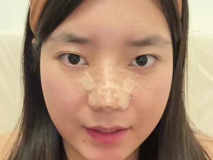 我很好 谢谢大家关心