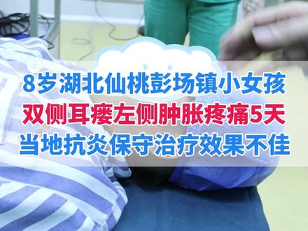 耳前瘘管第一次感染,要一次麻醉解决双侧耳瘘问题#耳前瘘管 #抖出健康知识宝藏 #我的年度健康盘点 #武汉陈金辉