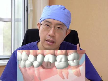 没有满18岁的孩子,缺牙该如何修复呢?#医学科普 #缺牙 #口腔科庄锐