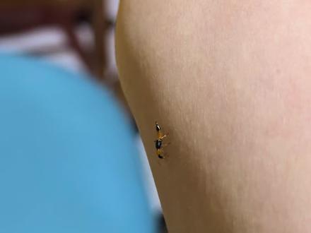 整个青州都在研究这个东西吗?#隐翅虫的毒液堪比硫酸