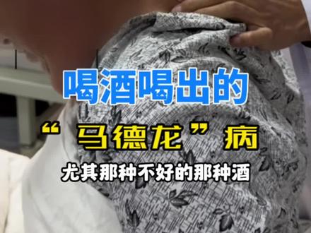 看到这个视频,你还敢喝酒吗?#马德龙病 #医学科普 #健康守护计划 #dou来说健康 #喝酒的危害
