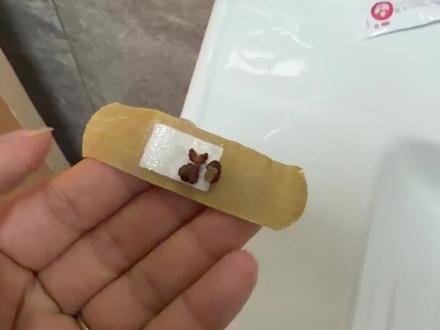 花椒贴肚脐打卡第12天 坚持就是胜利 #祛湿 #花椒贴肚脐