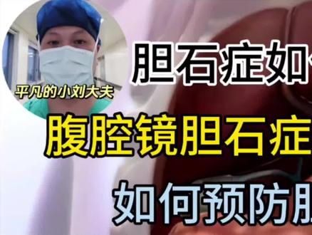 胆石症如何形成?如何预防它?腹腔镜手术治疗胆石症动画演示! #胆石症 #胆囊结石 #腹腔镜手术 #动画演示 #预防胆结石