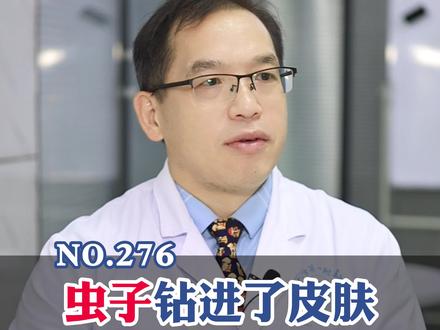 NO.276:疥疮感染可能会传染给家人,正确处理很关键!#疥疮 #疥螨 #健康 #科普
