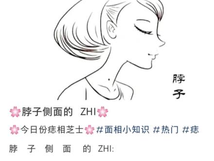 #热门
脖子侧面得痣:贵人痣