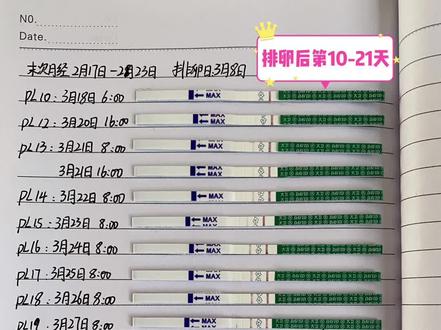 hcg翻倍成功👏pl 20天大卫也终于强阳毕业✅
🧡每个刚怀孕的妈妈都非常的玻璃心,有着各种担心,害怕万一生化怎么办?万一不翻倍怎么办?其实我也一样……所以每天认真记录、对比早早孕试纸的变化,观察着身体的变化,去感受宝宝的存在🤰
🧡下面给大家分享一下,我的最近总结的一些感受与经验:
~~~~~~
1️⃣什么时候可以开始测早早孕?
💁♀️在排卵后第10天,就可以开始测早早孕,但是建议用金秀儿或可丽蓝来测,相对比较敏感,而大卫比较高冷,一般要到排卵后12-14天才可以测到。
⚠️万一第10天没有测到,也不要灰心,有的人着床晚,可以等到14天左右再测。
⚠️早早孕最好用晨尿测,浓度更高,显色更明显。
~~~~~~
2️⃣早早孕有什么症状?
✅着床期(排卵后7天左右)小腹有明显坠胀感,后腰也有些酸胀的疼,和姨妈痛有点像
✅非常嗜睡,脑子有点昏昏沉沉,总觉得犯困(和我吃了黄体酮胶囊也有一定关系)
✅屁多且臭,而且打嗝频率增加
✅PL后19天开始,🐻胀痛
⚠️症状仅供参考,但是每个人的症状也有不一样,大家还是尽量放松心情,不要去套症状哦
~~~~~~
3️⃣什么时候去抽血?
💁♀️建议排卵后14天以后去抽血,再晚一些也可以,但是一定要自己在家用早早孕试纸观察,是否每天有颜色加深,如果连续2-3天卡住不加深了,要及时去医院检查
✅医生一般会建议48小时内抽第二次血,看血值翻倍情况
~~~~~~
4️⃣hcg的正常范围应该是怎么样的?
🔻以湖南省妇幼提供的参考区间做参考,单位IU/L:
未孕:0-5.3
孕3周:5.8-71.2
孕4周:9.5-750
孕5周:217-7138
孕6周:758-31795
孕7周:3697-163563
~~~~~~
5️⃣早早孕试纸颜色变化参考
💁♀️图片附上我记录的早早孕试纸颜色变化,供大家做个对照
‼️还没有强阳的姐妹不要着急,只要颜色慢慢加深,就肯定可以等到强阳的!
⚠️早早孕测到之后,排卵试纸确实也会复阳,但是不建议用排卵试纸复阳来做是否怀孕的判断,因为有些人姨妈来之前2天测排卵试纸,也可能会复阳。
⚠️注意不要把早早孕试纸和排卵试纸放到同一个尿杯里测试,会串色,影响测试结果。
以上,希望这些经验对大家有帮助哟~也㊗️所有备孕姐妹都能早日好孕‼️
#备孕日记 #早孕试纸 #早孕反应 #早孕