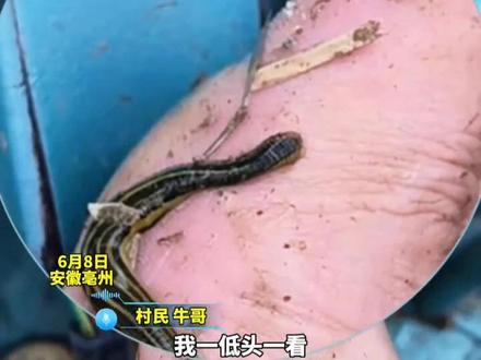 村民干农活不慎被#蚂蝗叮咬 医生:不要强行拉扯 用酒精、风油精等物质喷表面让其自行脱落(记者:付成行 编审:张妍)