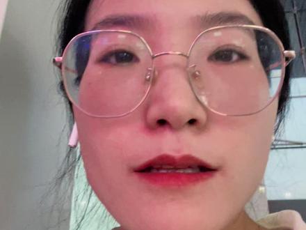 #银屑病牛皮癣 小知识。#生物制剂 接上篇