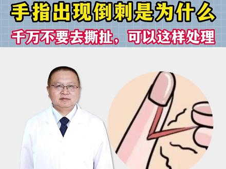 手指出现倒刺不要拔和撕拉,可以用指甲剪去剪掉#成都 #皮肤科医生